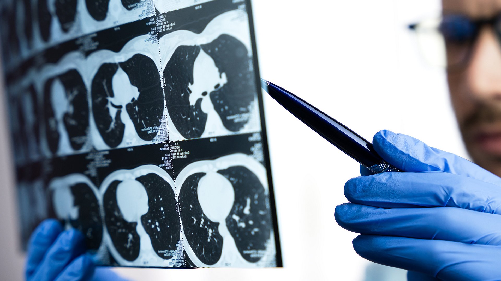 Ein Arzt untersucht einen CT-Scan