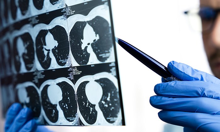 Ein Arzt untersucht einen CT-Scan
