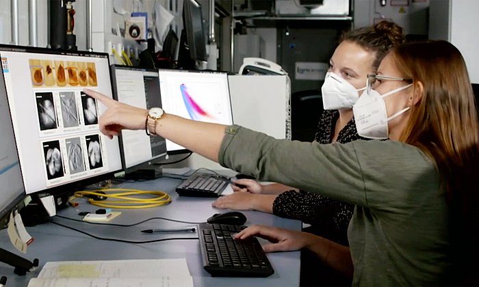 The dark field x-ray technology can reveal the damage to lung tissue caused by diseases such as COPD or Covid-19.