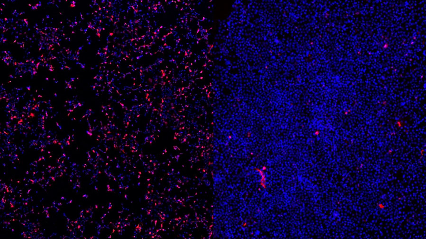 Cell uptake ASO therapies