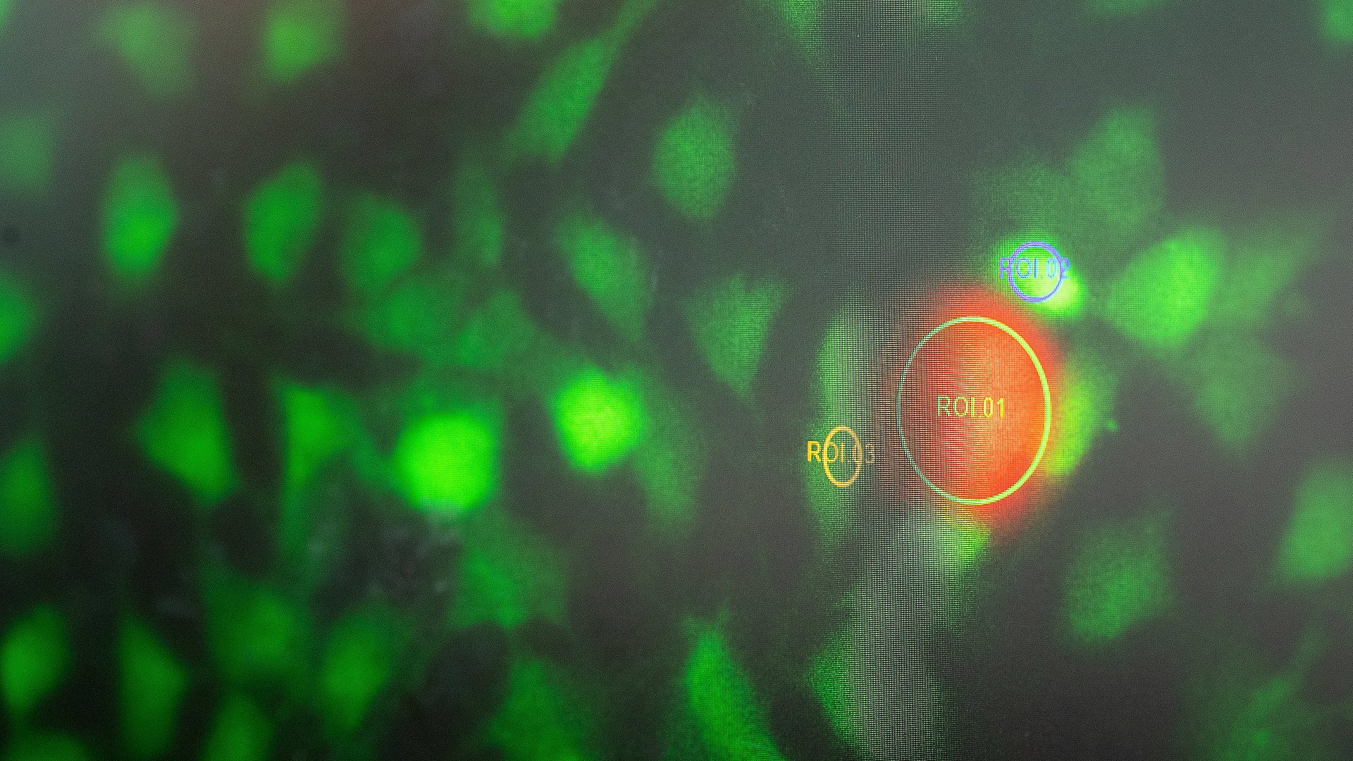 A nanorobot (orange) in the laboratory of Prof. Berna Özkale Edelmann