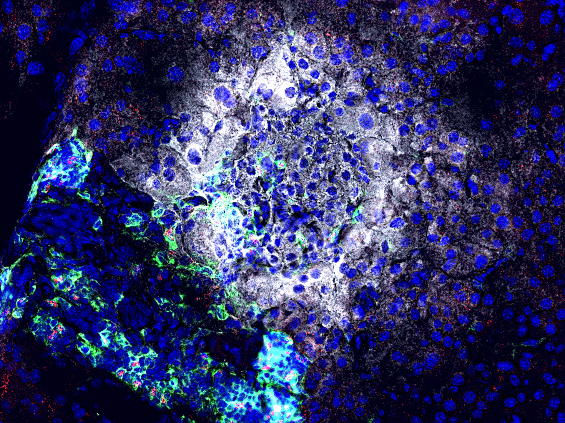 Treatment with an Antagomir directed against miR92a results in reduced attacks of immune cells (green) on the insulin (white) producing beta cells directly in the pancreas. Moreover, the treatment leads to more regulatory T cells (red) able to protect the beta cells. (Photo: Helmholtz Zentrum Munich)
