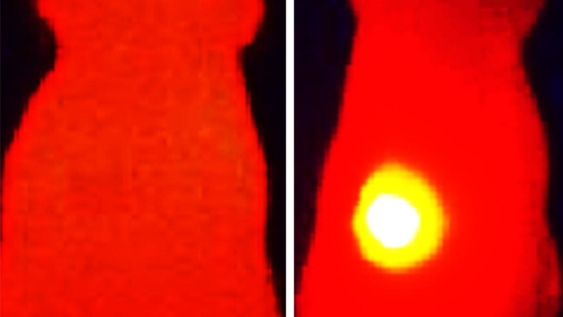 Das Infrarot-Wärmebild auf der rechten Seite zeigt eine Maus, die mit OMVs mit Melanin behandelt wurde. Der Tumor (gelb) zeigt eine Temperaturerhöhung nach der Laserbestrahlung. Auf der linken Seite wurde die Maus mit OMVs ohne Melanin behandelt. 