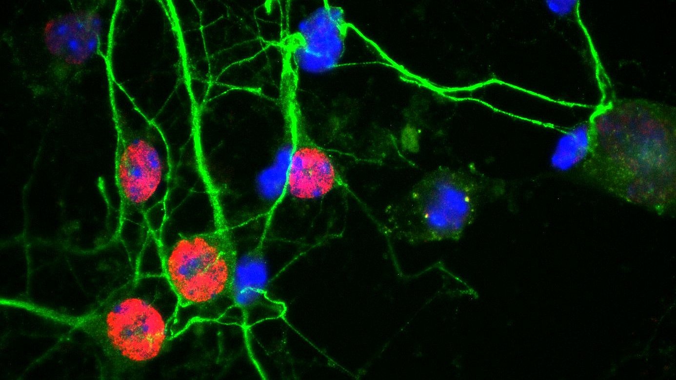 Cortical nerve cells from mice