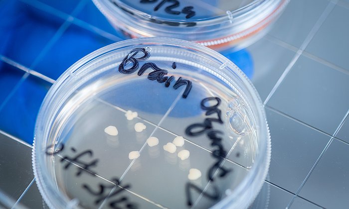 Brain organoids in a petri dish