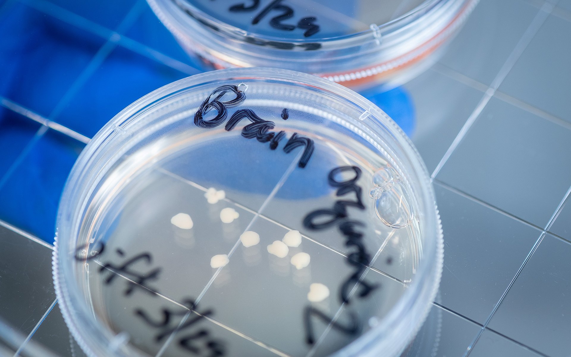 Brain organoids in a petri dish
