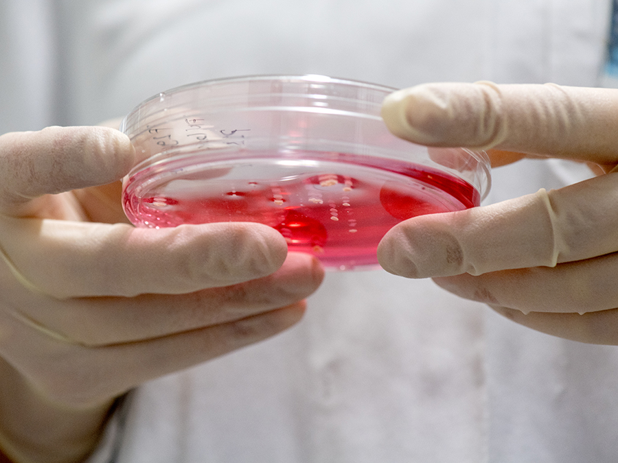 Cell cultures are an important tool for oncologic basic research. (Image: A. Heddergott / TUM)