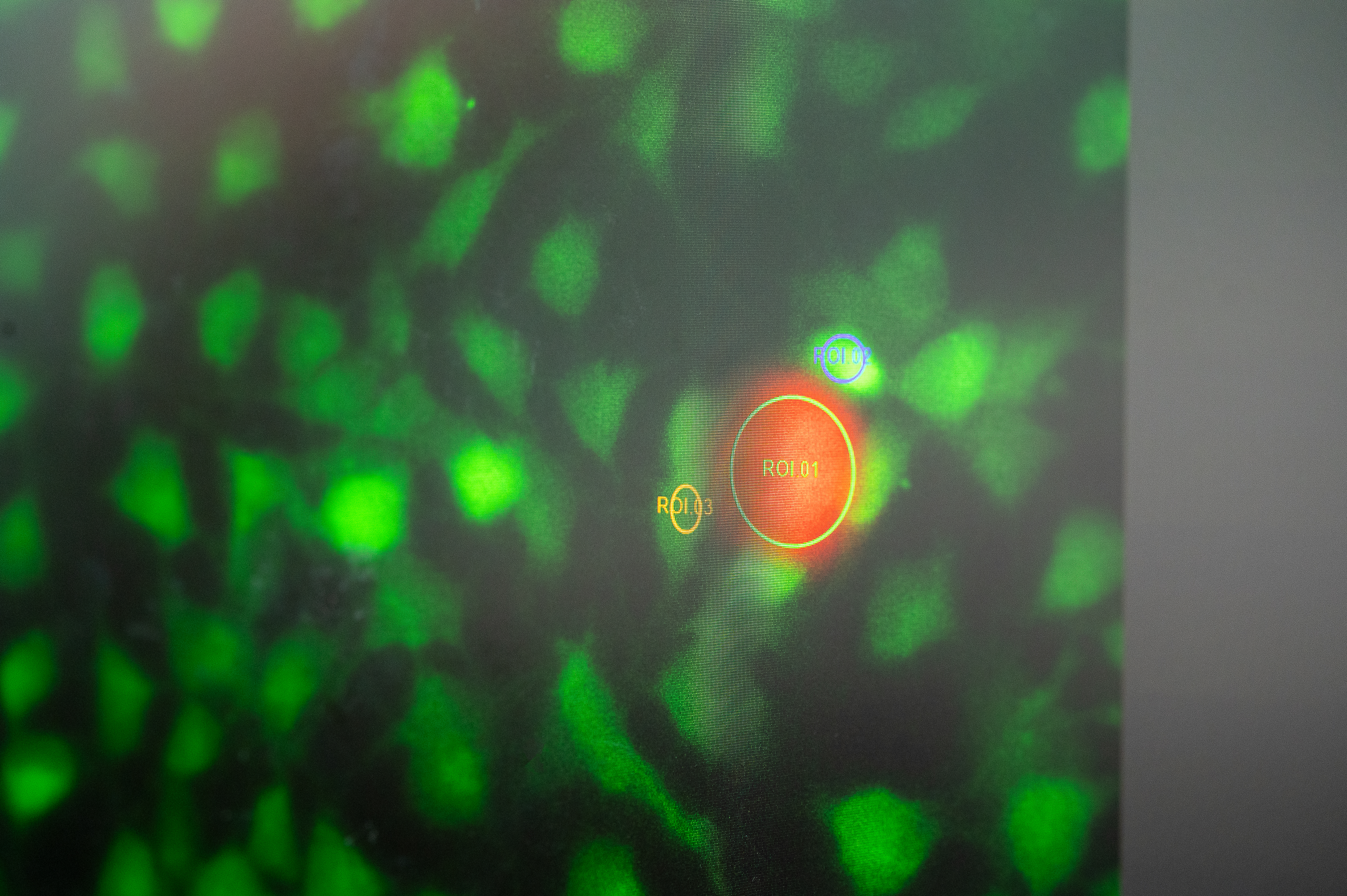 A nanorobot (orange) in the laboratory of Prof. Berna Özkale Edelmann