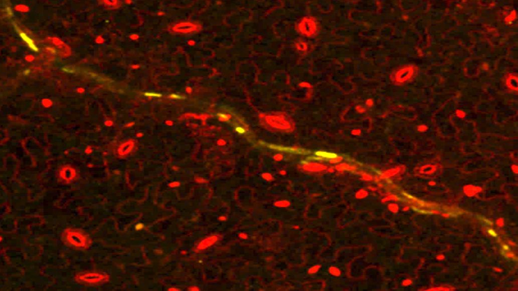 A microscope image can be seen. The background is black, a yellow fragmented and serpentine line runs from the bottom right to the top left. In addition, various small ovals can be seen in red on a background of red serpentine lines.
